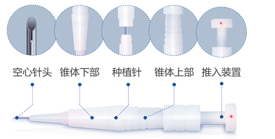 大麦公式の微針器具の分解図。中空の針先と毛包を送り出す構造を示す